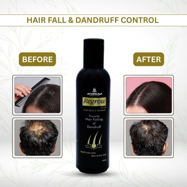 Regrow Hair Oil - Image 3