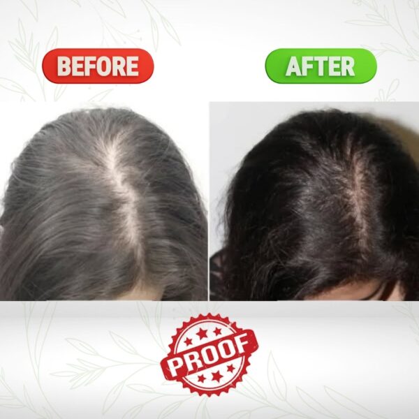 Regrow Hair Oil - Image 4