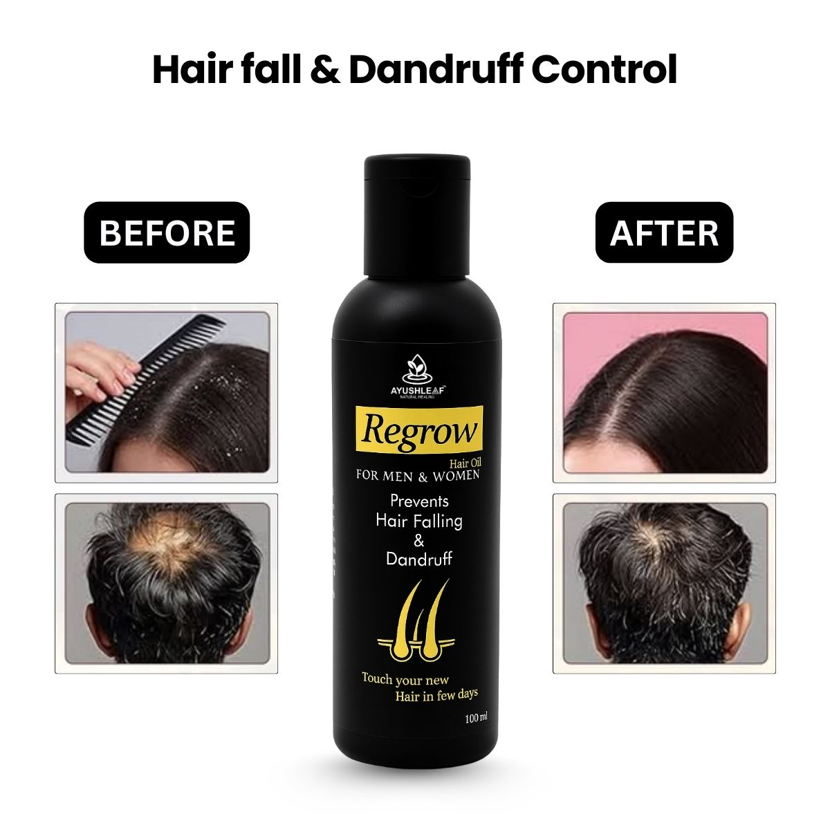 regrow hair oil
