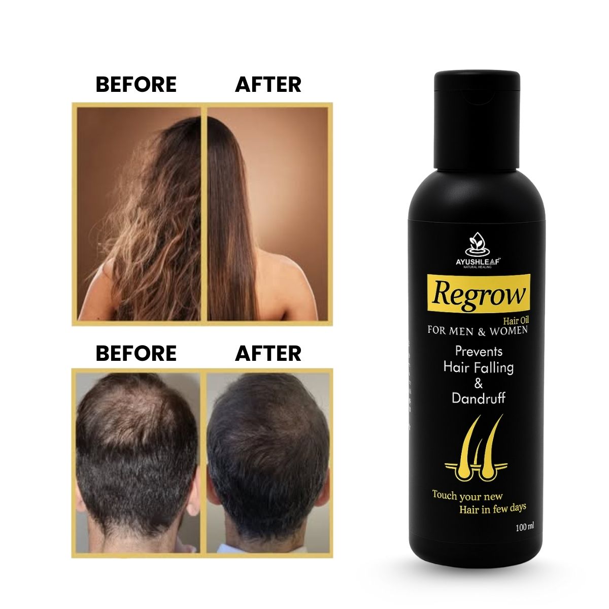 regrow hair oil